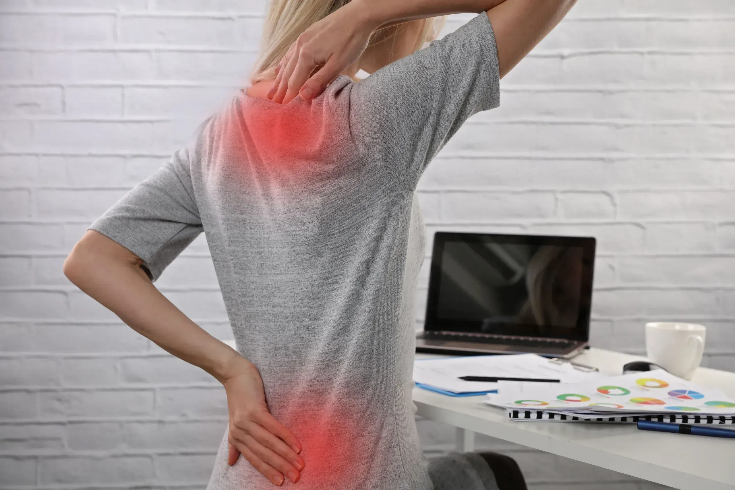 Diagram showing disc herniation and nerve compression at Arise Integrative Wellness