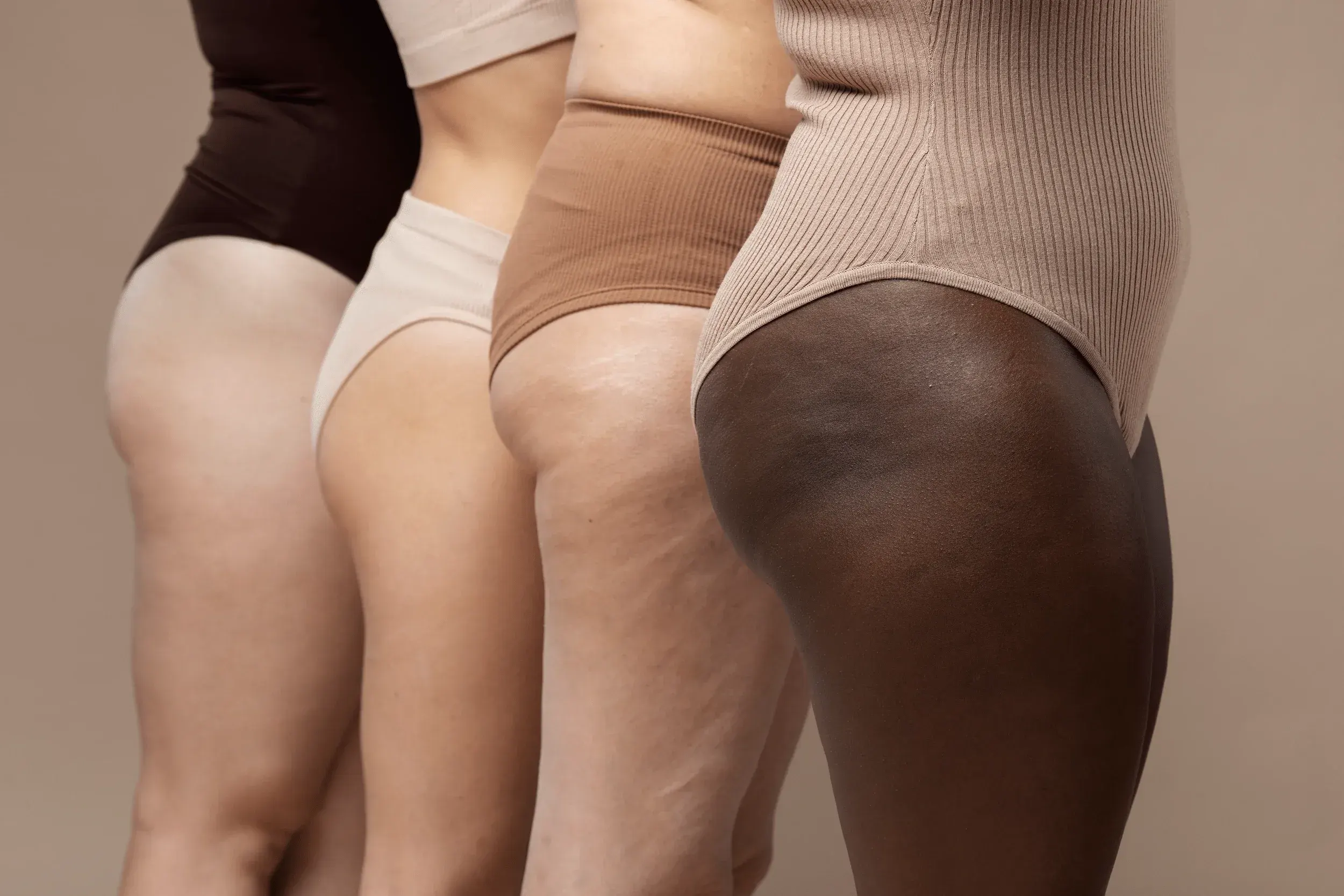 Lifestyle factors affecting cellulite at Arise Integrative Wellness Port Charlotte