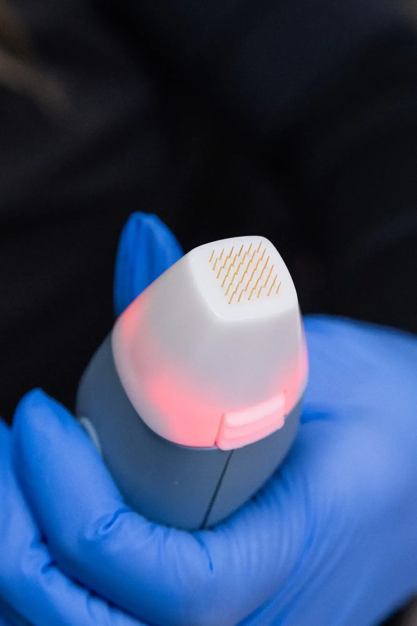 What Is Exion Clear RF?