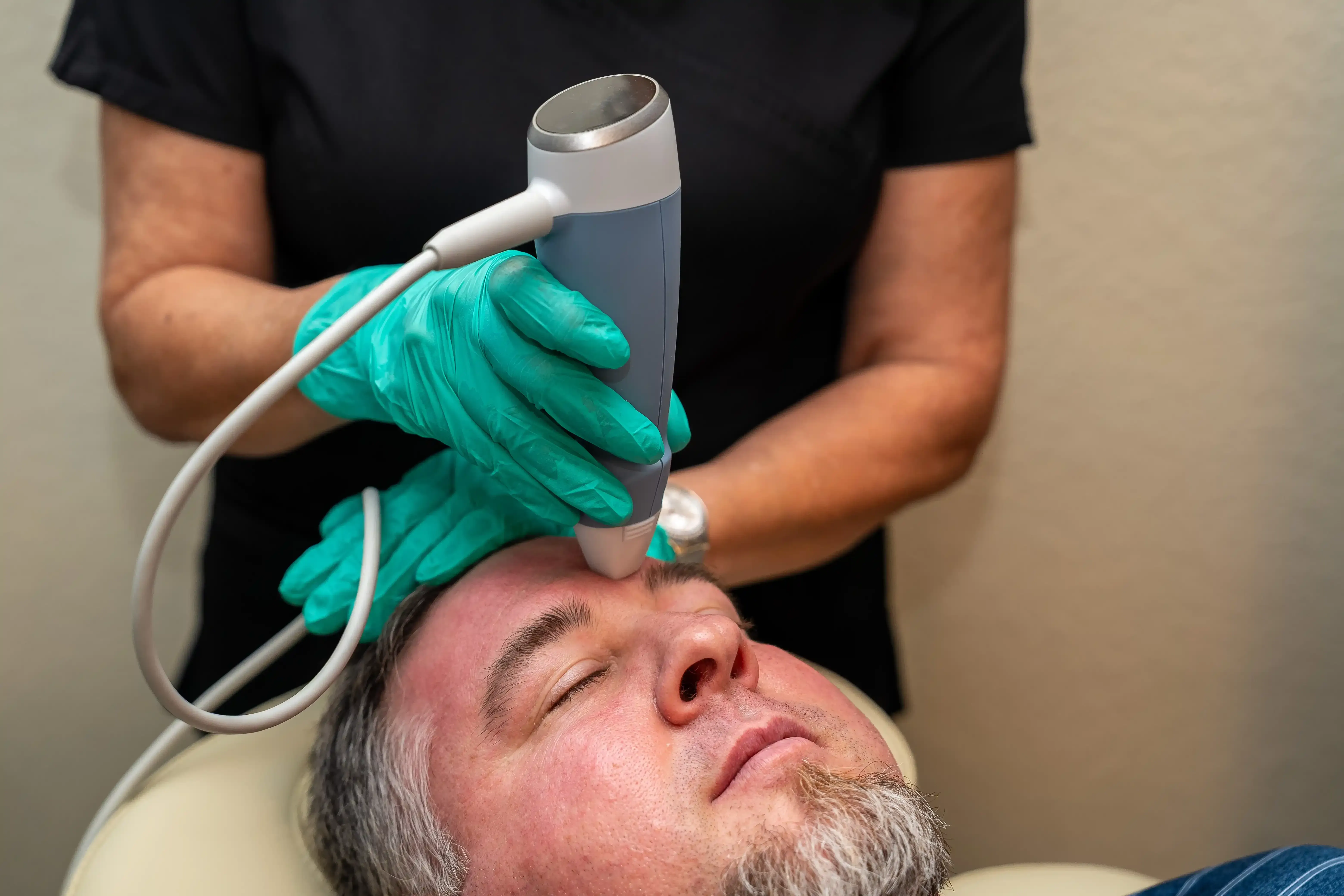 Benefits of Exion RF Microneedling
