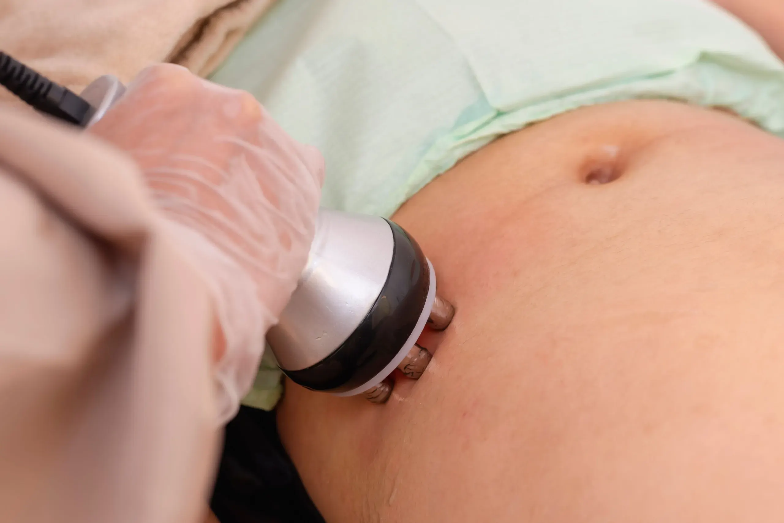 Patient consultation for LightForce laser therapy benefits at Arise Integrative Wellness Port Charlotte