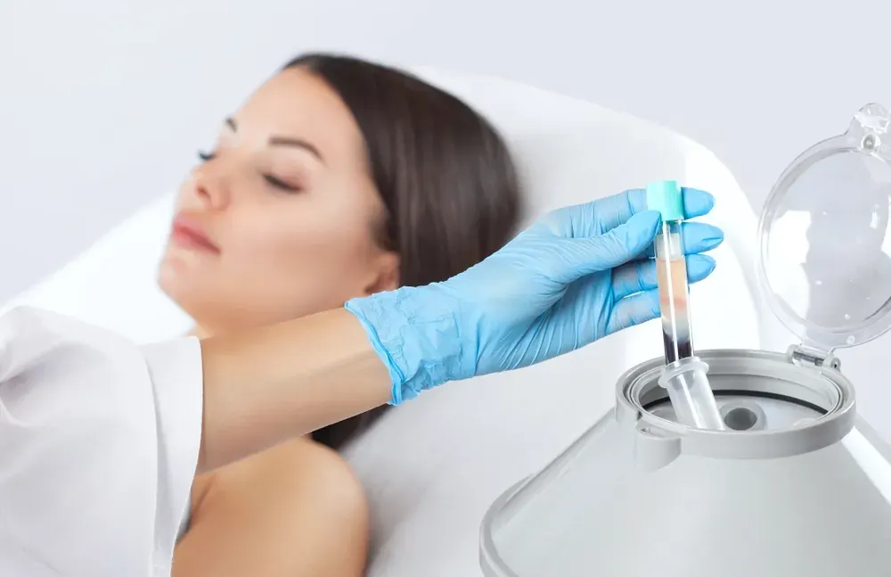 PRP therapy treatment at Arise Integrative Wellness in Port Charlotte Florida